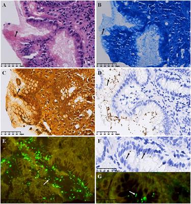 Improving the detection of Helicobacter pylori in biopsies of chronic gastritis: a comparative analysis of H&E, methylene blue, Warthin-Starry, immunohistochemistry, and quantum dots immunohistochemistry